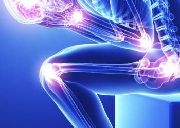 A szisztémás lupus erythematosus (SLE) mozgásszervi panaszai, tünetei és ezek kezelési lehetőségei